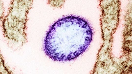 Các cơ sở y tế chủ động phòng, chống bệnh do virus Nipah