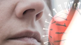 Infographic: Người nhiễm virus Nipah có triệu chứng ban đầu như thế nào?