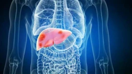 Cách phục hồi gan sau rượu bia ngày Tết Nguyên đán