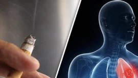 9 ca ung thư phổi đầu tiên từ nghiên cứu mới ở Singapore đều là người không hút thuốc