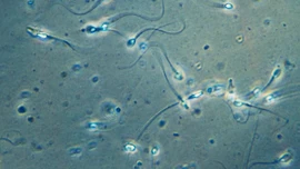 Ca mang thai đầu tiên trên thế giới nhờ phương pháp thu hồi tinh trùng do AI hỗ trợ