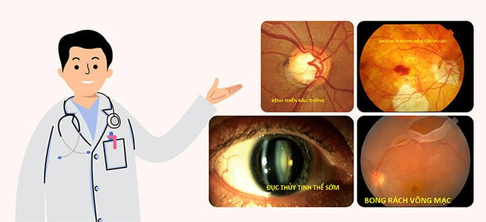 Cha mẹ nên cho con đi khám mắt định kỳ theo độ tuổi.