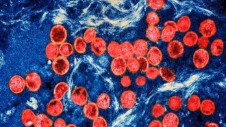 Giới nghiên cứu: Virus gây bệnh đậu mùa khỉ đang biến đổi nhanh hơn bình thường