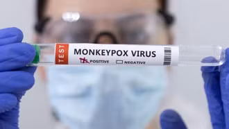 Các nước tăng cường kiểm dịch nhập cảnh để ngăn virus đậu mùa khỉ