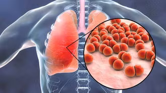 Những biến chứng nguy hiểm của cúm A nếu không phát hiện và điều trị kịp thời