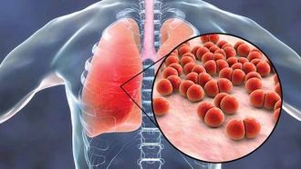 Những biến chứng nguy hiểm của cúm A nếu không phát hiện và điều trị kịp thời