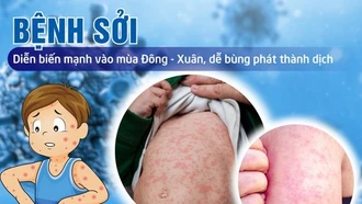 Thủ tướng yêu cầu tăng cường công tác phòng, chống bệnh sởi