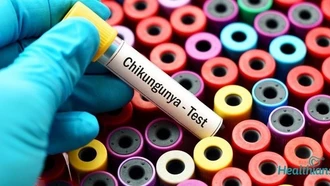 Không nên tự ý điều trị khi có dấu hiệu mắc Chikungunya