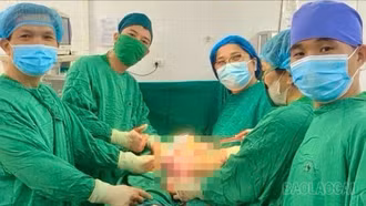 Bệnh viện Đa khoa số 3 tỉnh Lào Cai: Phẫu thuật thành công khối u buồng trứng nặng 3kg