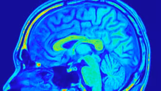 AI tạo bước đột phá quan trọng trong chẩn đoán ung thư