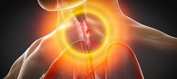 Nhung phat hien khoa hoc moi giup dieu tri ung thu thuc quan hinh anh 1