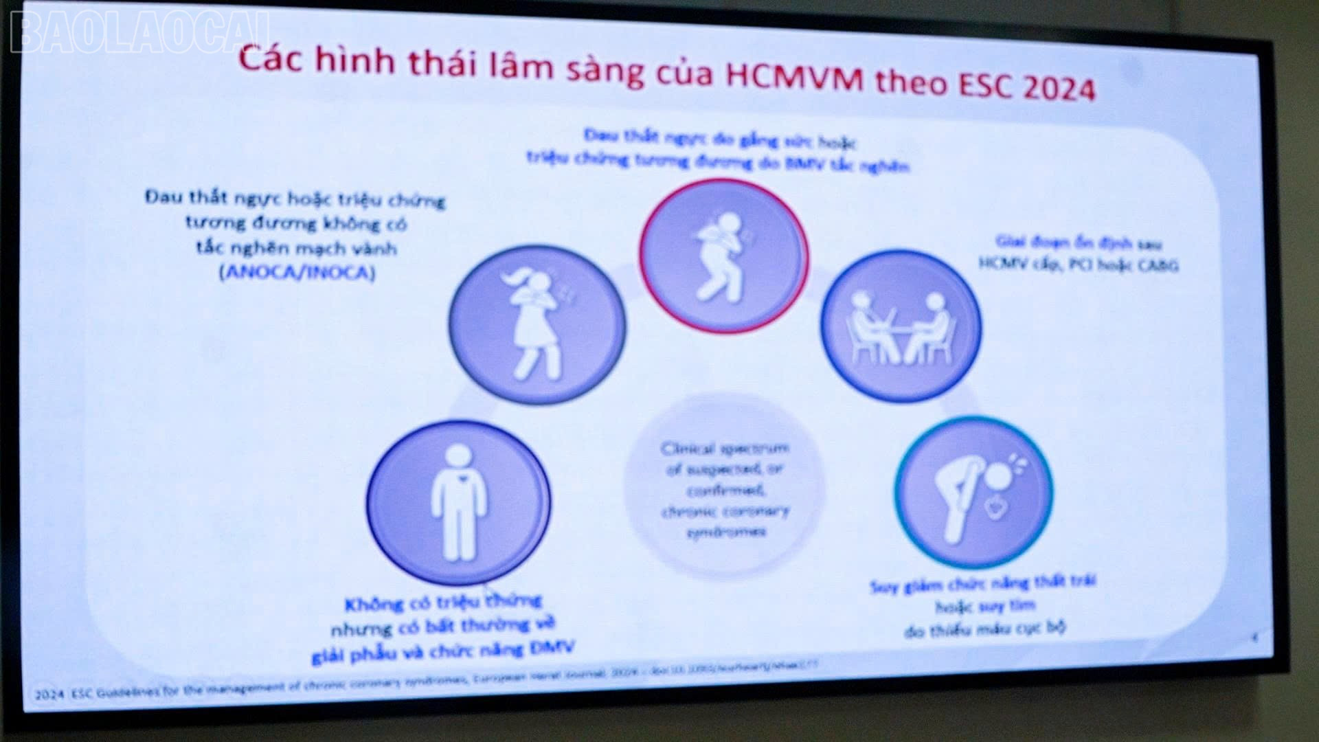 TS.BS Nguyễn Quốc Thái - Phó viện trưởng viện Tim mạch, Bệnh viện Bạch Mai và nội dung trình bày tại Hội thảo. baolaocai-tl_z6910249403843-1891d791a67bd9f5deb49be8a80ba134.jpg