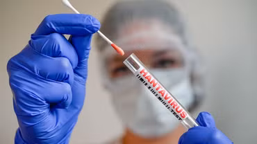 Virus Hanta khác COVID-19 như thế nào?