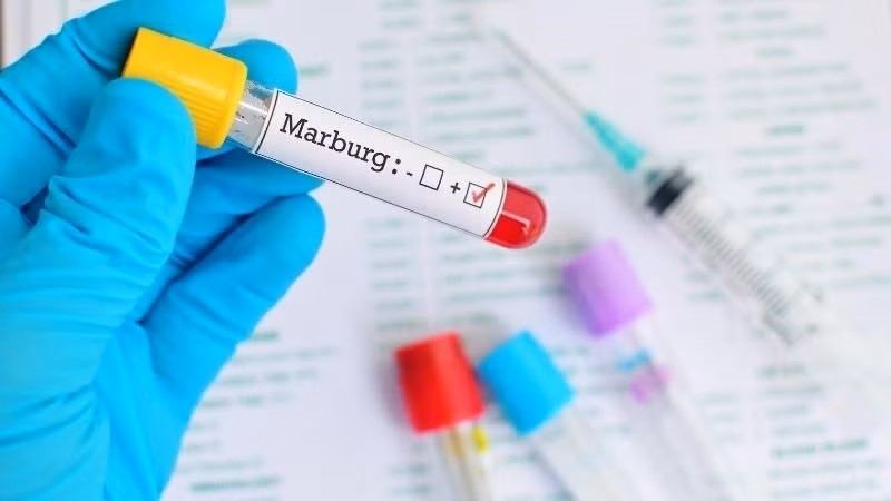 Ethiopia xác nhận sự bùng phát của virus Marbug gây chết người ảnh 1