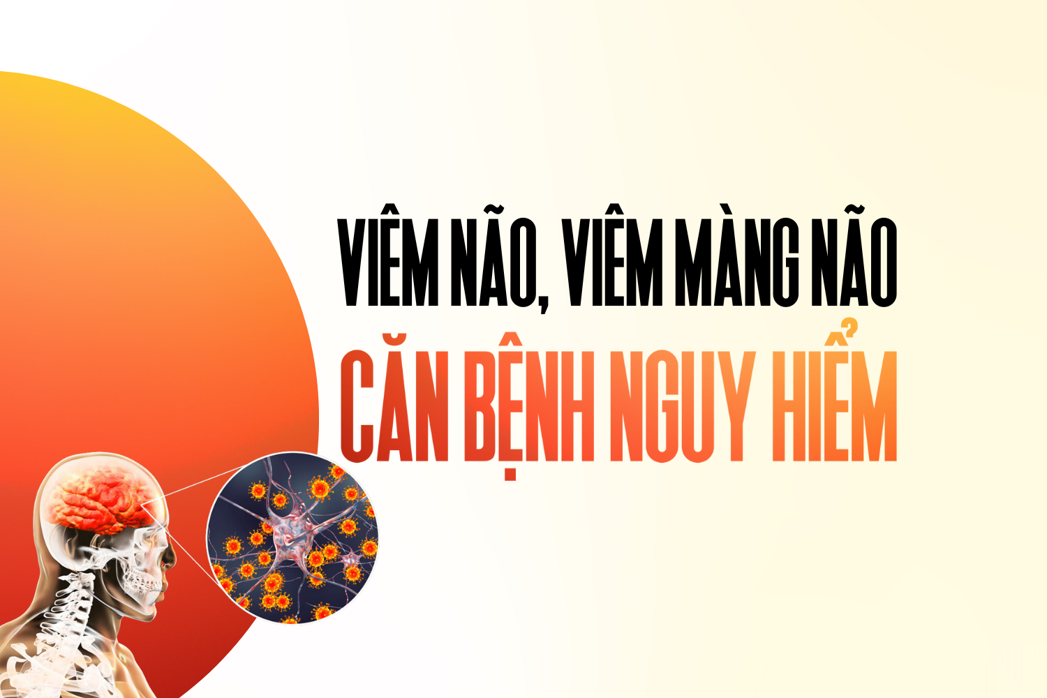 [Infographic] Viêm não, viêm màng não – căn bệnh nguy hiểm