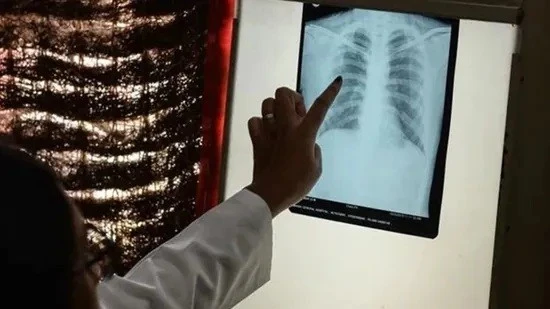 Bệnh lao vẫn là một trong những căn bệnh truyền nhiễm nguy hiểm nhất thế giới.