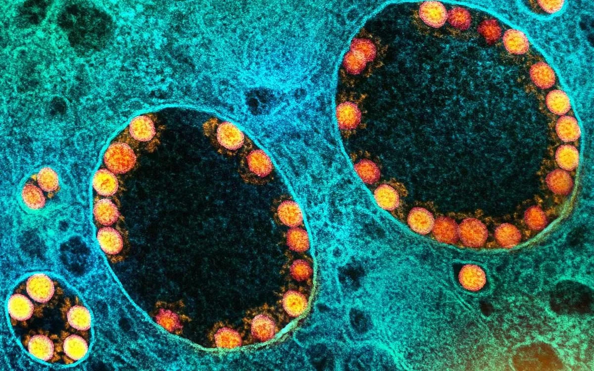 Do virus gây COVID-19 (màu vàng) và các loại virus RNA khác xâm nhập vào tế bào thông qua thể nội bào (endosome), nên các tạp chất trong vaccine mRNA có thể kích hoạt những phản ứng miễn dịch tương tự.
