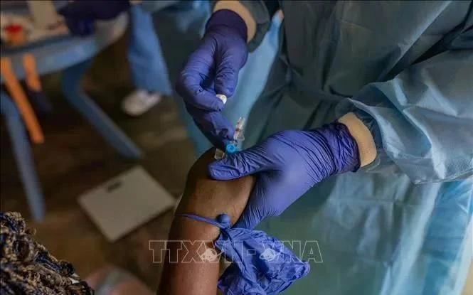 Nhân viên y tế điều trị cho bệnh nhân mắc đậu mùa khỉ tại bệnh viện ở tỉnh Bắc Kivu, CHDC Congo ngày 19/8/2024.