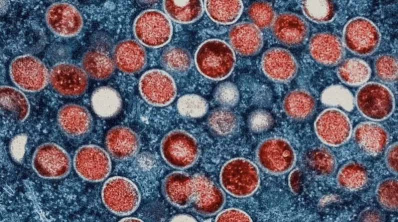 Virus đậu mùa khỉ. Ảnh: Thai PBS