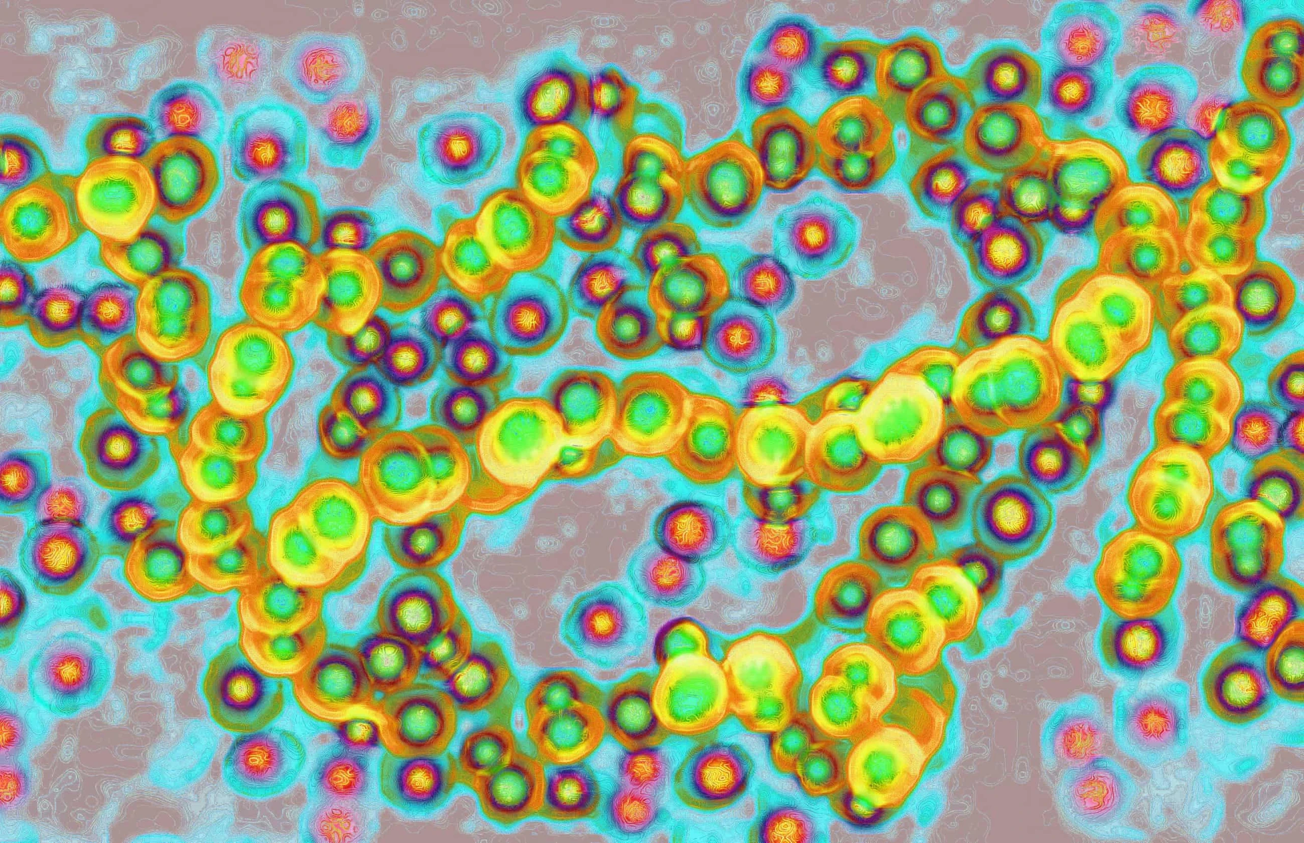 Vi khuẩn Streptococcus pyogenes là nguyên nhân trong hầu hết các trường hợp sốc nhiễm độc liên cầu khuẩn, hay STSS.