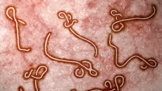WHO cảnh báo Ebola toàn cầu, Việt Nam chủ động ứng phó