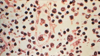 Chile báo động virus Hanta, 5 công dân Pháp xuất hiện triệu chứng sau khi đi du lịch trở về