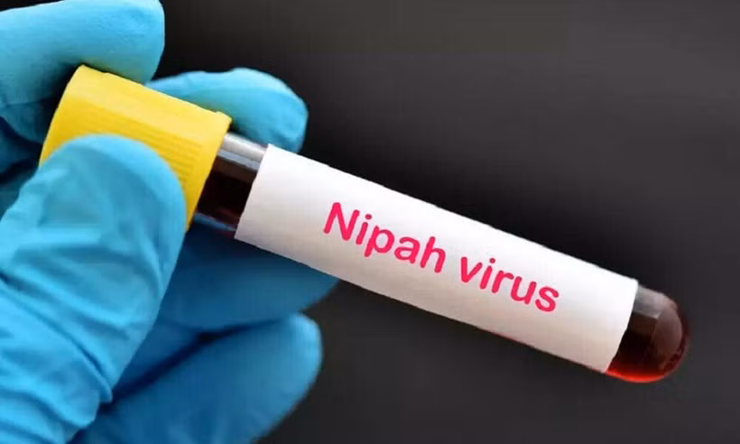 virus-nipah-6818.jpg