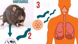 Bộ Y tế khuyến cáo về virus Hanta sau chùm ca tử vong ở tàu du lịch nước ngoài