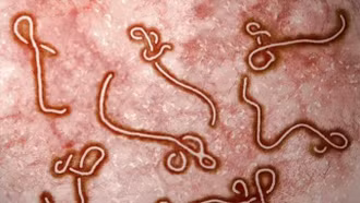 Bao giờ thế giới mới có vaccine chống chủng Ebola mới?
