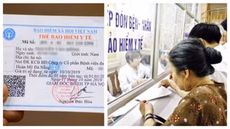 Mổ ruột thừa có được BHYT thanh toán không? Thanh toán bao nhiêu phần trăm?