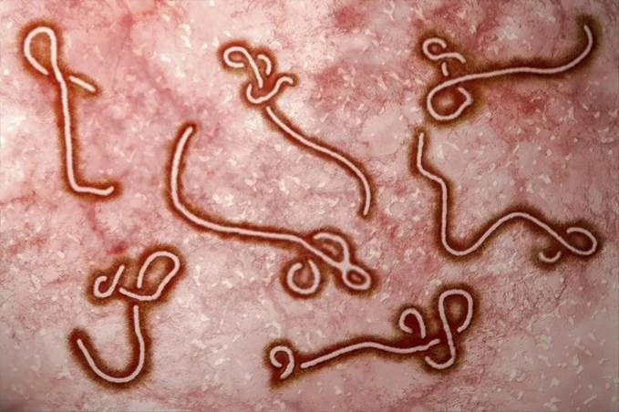ebola2.jpg