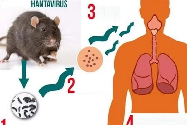 virus.jpg