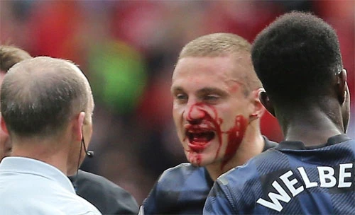 Vidic sẵn sàng đổ máu nếu điều đó có thể giúp ích cho đội nhà.