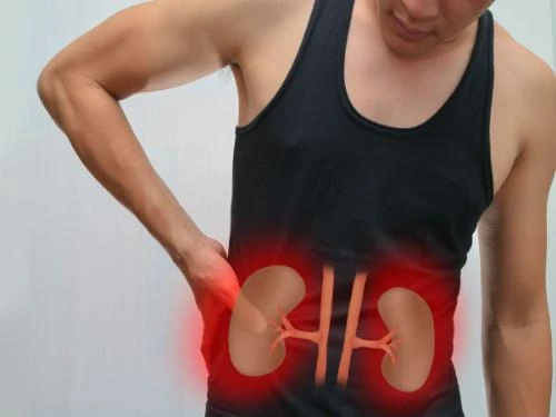 Coi chừng các cơn đau quặn thận.