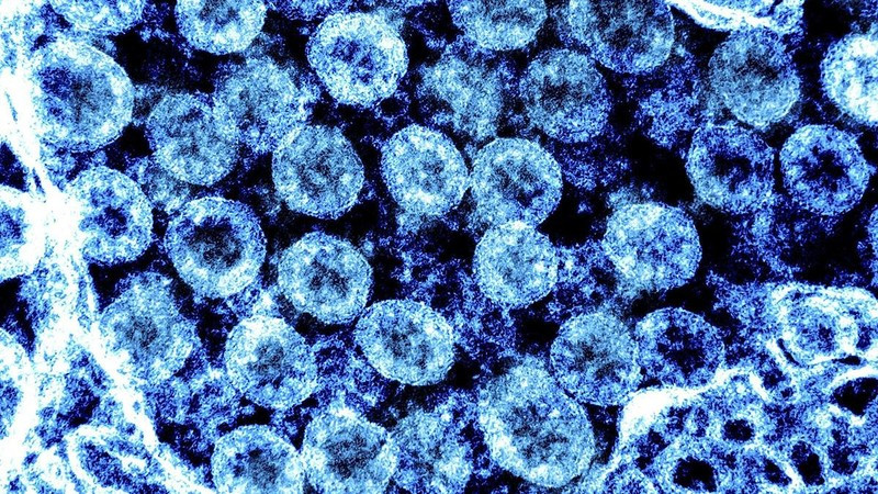 Sử dụng trí tuệ nhân tạo dự báo tiến hóa của virus SARS-CoV-2 ảnh 1 Hình ảnh từ kính hiển vi virus SARS-CoV-2 trong mẫu bệnh phẩm của bệnh nhân mắc Covid-19. (Ảnh: AFP/TTXVN)
