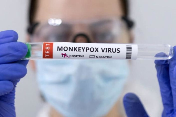 Ống đựng mẫu bệnh phẩm được đánh dấu dương tính với virus gây bệnh đậu mùa khỉ. (Ảnh: Reuters) Ống đựng mẫu bệnh phẩm được đánh dấu dương tính với virus gây bệnh đậu mùa khỉ. (Ảnh: Reuters)
