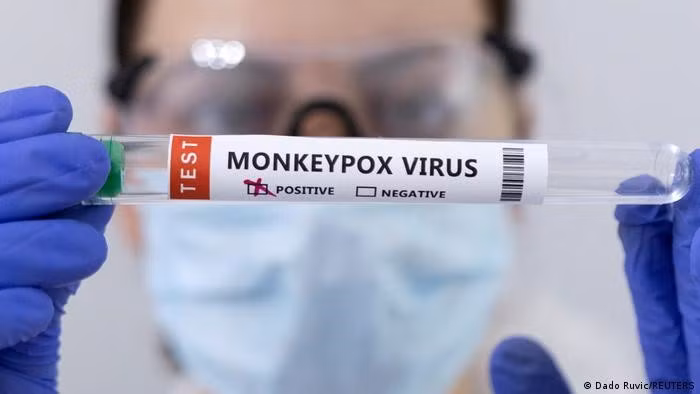 Số ca mắc đậu mùa khỉ vẫn tiếp tục tăng tại nhiều nước ảnh 1