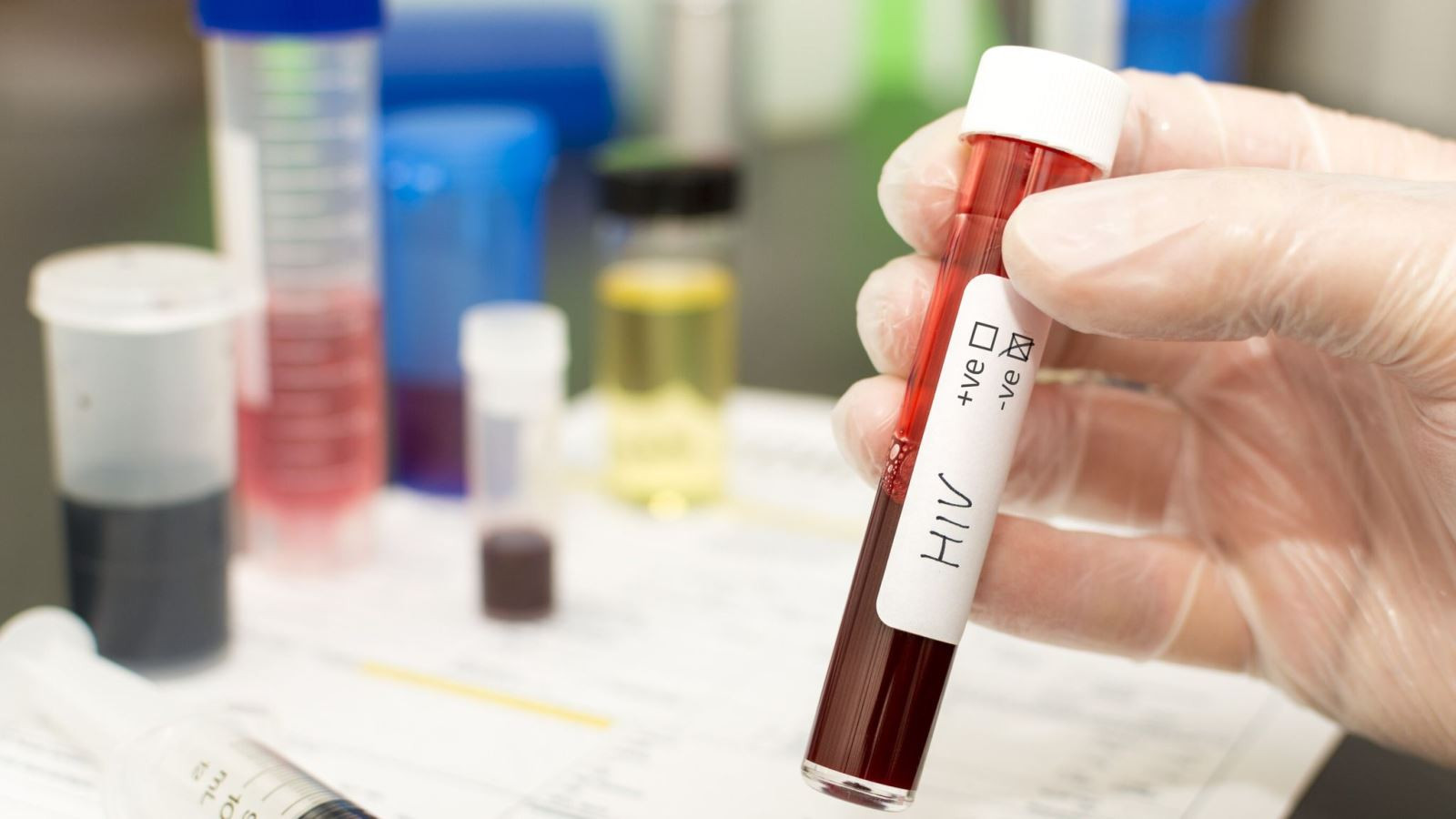 Người thứ 5 trên thế giới được chữa khỏi HIV  ảnh 1 Chú thích ảnh