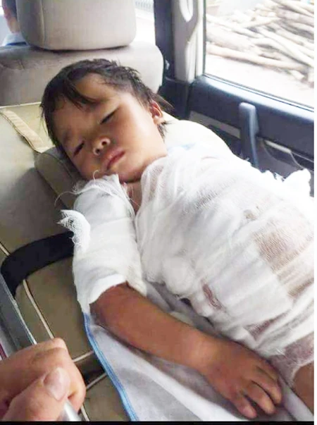 Em Phà Xe Sợ đang phải chịu rất nhiều đau đớn.