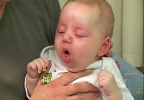 Trẻ cần được tiêm vắc xin để phòng tránh bệnh ho gà (ảnh minh họa) Trẻ cần được tiêm vắc xin để phòng tránh bệnh ho gà (ảnh minh họa)