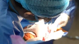 Ghép gan hồi sinh bệnh nhân từng "chờ chết"