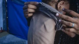 Nguy cơ nạn đói lan rộng tại hơn 15 điểm nóng toàn cầu