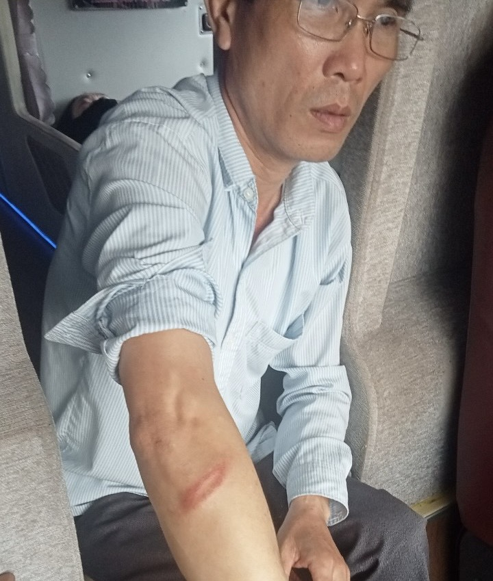 Anh T.Đ.Q cho biết:nhưng người này rất hung hãn và liên tục chửi bới, đe dọa khiến tôi và hành khách trên xe vô cùng hoảng sợ. z4909926156007_9b2a4517f65c720c756804a4970961c5-0821.jpg
