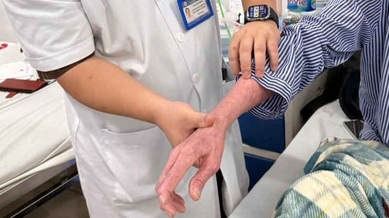 Các tổn thương của người bệnh. dalieu.jpg