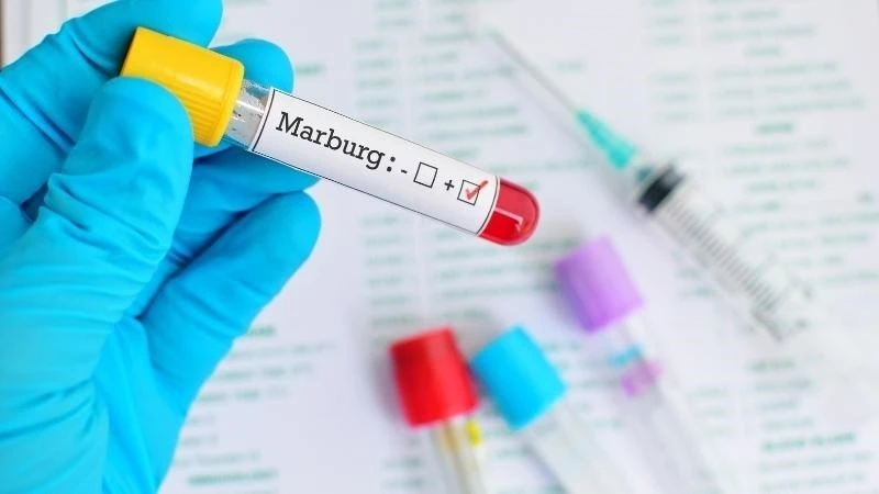 Ethiopia xác nhận sự bùng phát của virus Marbug gây chết người ảnh 1