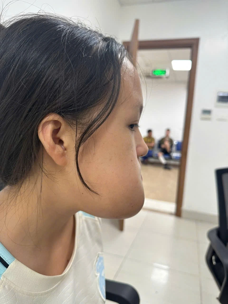 Khối u lớn khiến gương mặt bệnh nhân bị biến dạng.