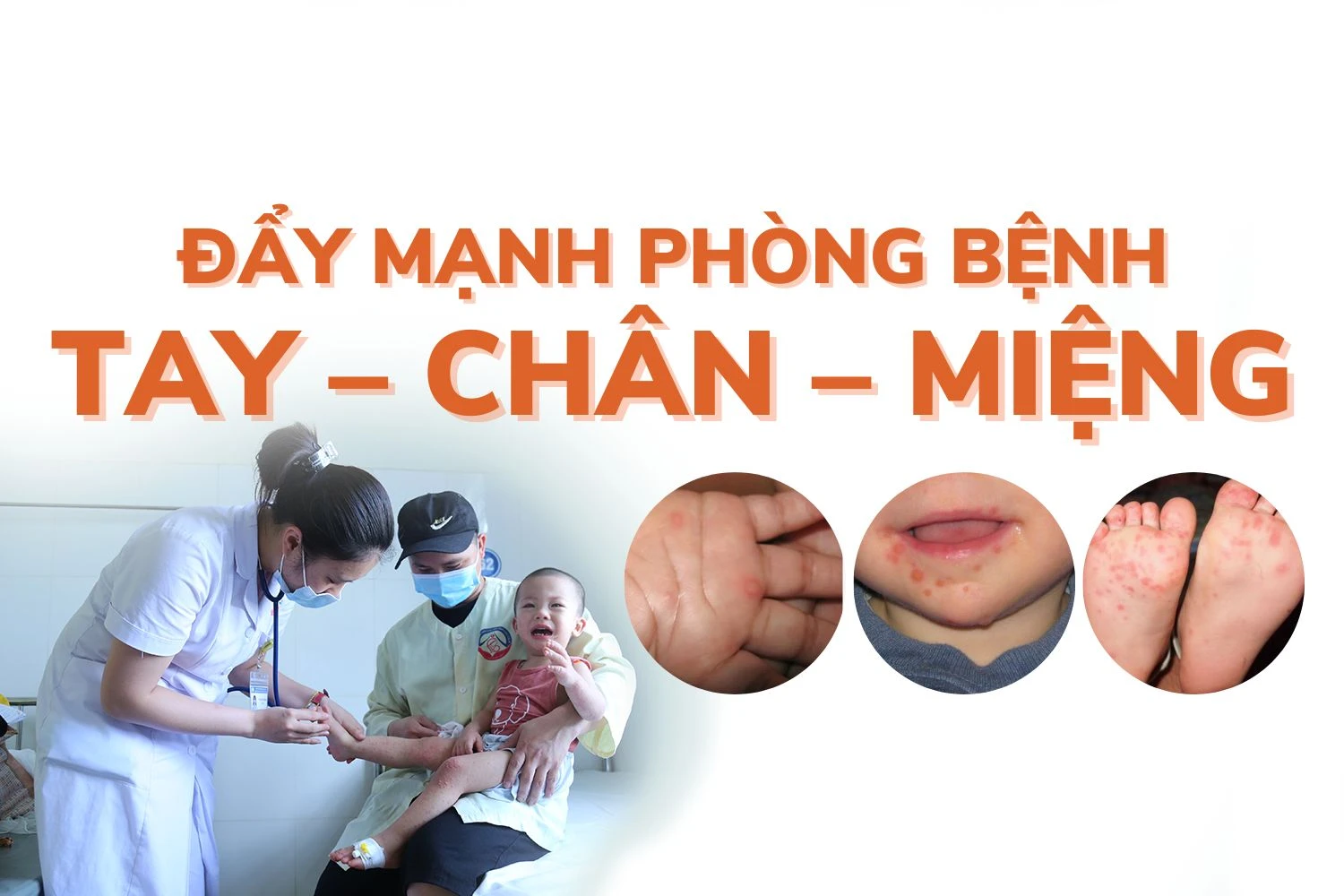 [Infographic] Bệnh tay - chân - miệng: dấu hiệu nhận biết và biện pháp phòng bệnh