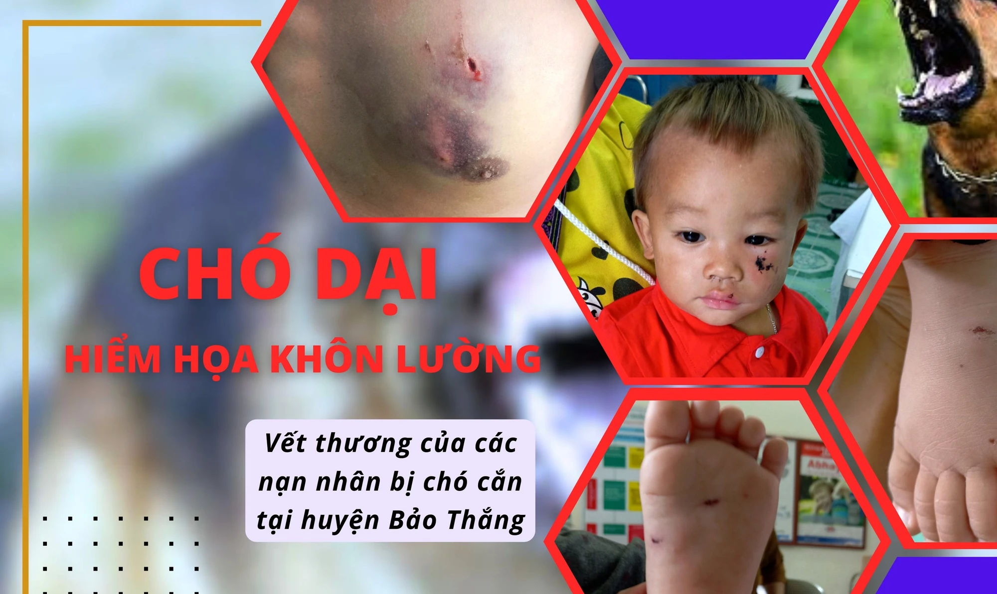 Bệnh dại trên chó - nỗi lo ở Bảo Thắng