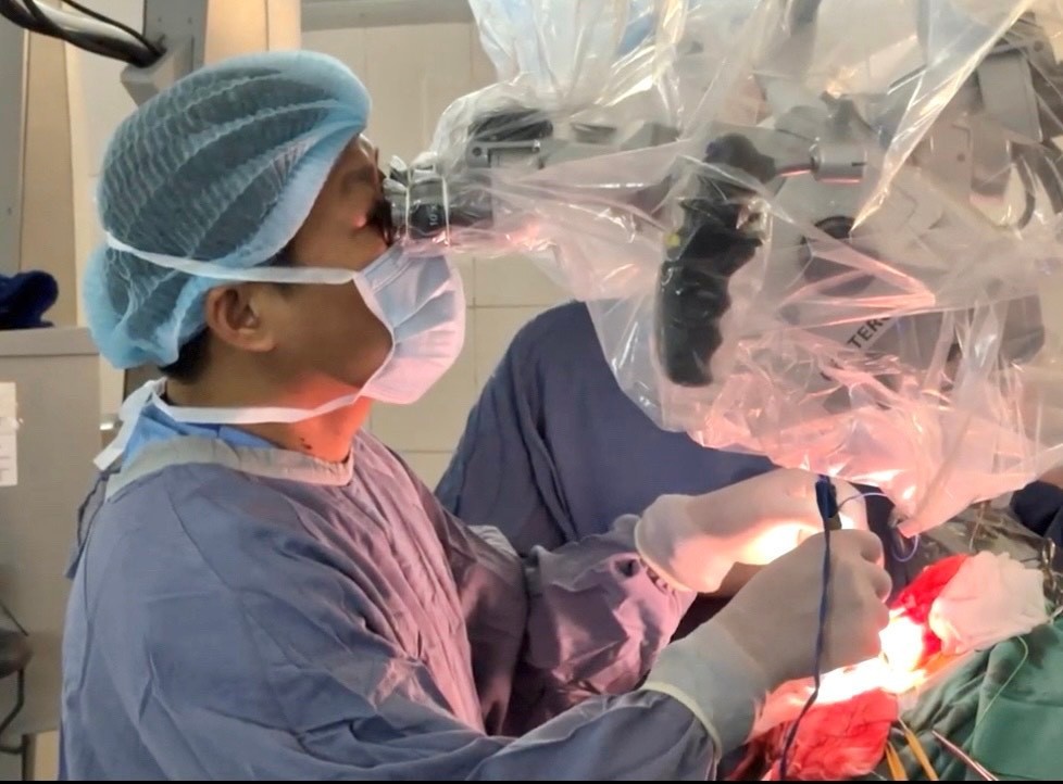 O cirurgião está tratando um paciente com epilepsia. Bác sĩ phẫu thuật cho bệnh nhân động kinh.