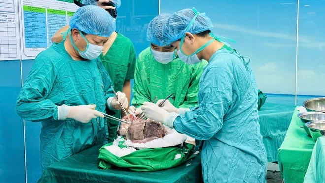 Bệnh viện Phổi Trung ương đang trong quá trình xây dựng Trung tâm Ghép phổi vùng.